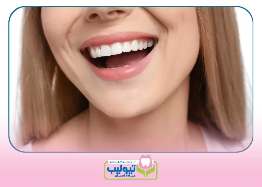 Hollywood Smile image