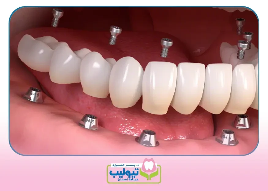 Permanent Teeth image